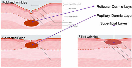 Medical Fractional Co2 Laser For Acne Scars Beauty Salon Equipment 10600nm Wavelength