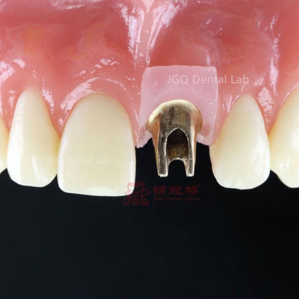 Custom Milled Dental Implant Abutments in Titanium Zirconia FDA CE Certification