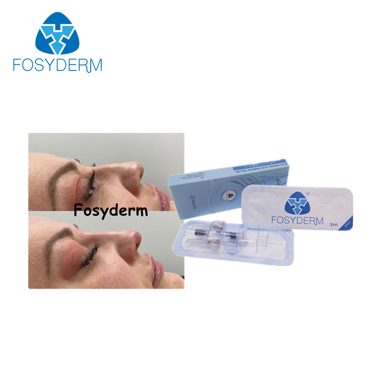 Крест Fosyderm соединил глубокую линию заполнитель заполнителя 2ml дермальный для носа вверх
