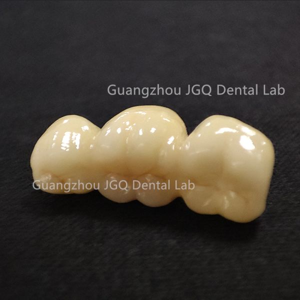 Monolithic Zirconia Crowns Dentures CAD/CAM 1200 MPa Flexural Strength for Dental Bridges