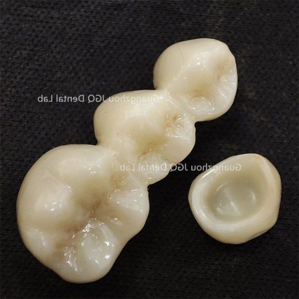 All Ceramic Crown Bridge Dental Laboratory Natural Looking With Aesthetic Effect