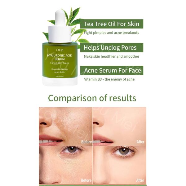 Árbol de té AHA Vitamina E Cuidado de la piel Sero para la hidratación Esencia de manchas negras