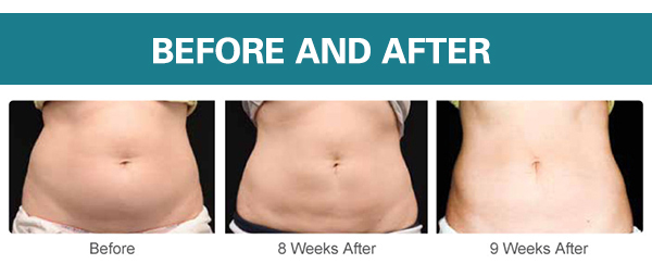 Durable Whitening / Body Slimming Equipment Metal Shell With 2 Working Handle