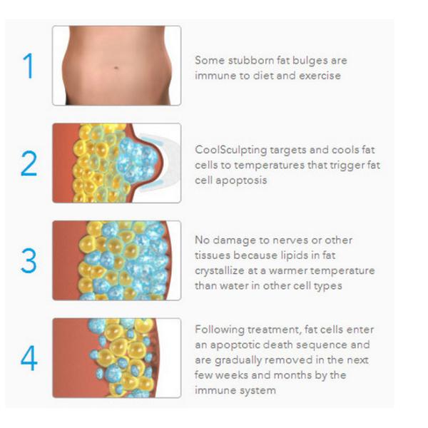 Fast Body Shaping Cryolipolysis Slimming Machine , Slimming Beauty Equipment