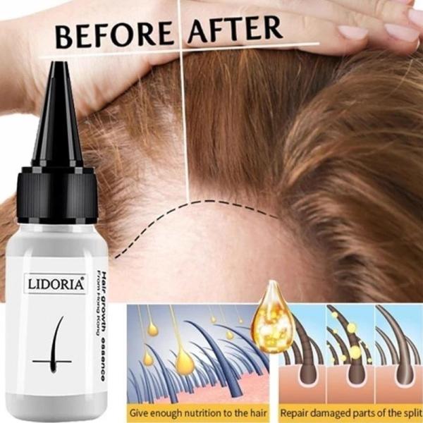 Polygonum Multiflorum Ginger Fast Hair Growth Serum Anti Hair Loss Liquid