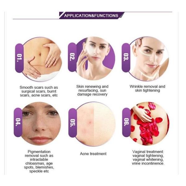 Лазер СО2 медицинской частичной длины волны контроля системы машины 10600нм красоты лазера частичный