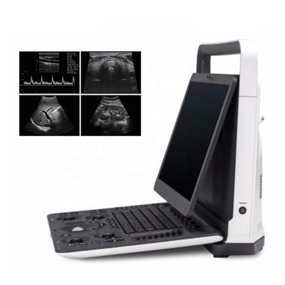 Hot Slaes Ecografo Portatil Sonoscape E2 Ultrasonido Portatil