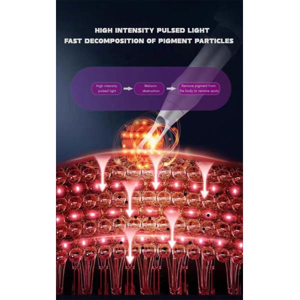 Advanced Pico Laser Technology for Fast and Effective Tattoo Removal at 1064nm 532nm
