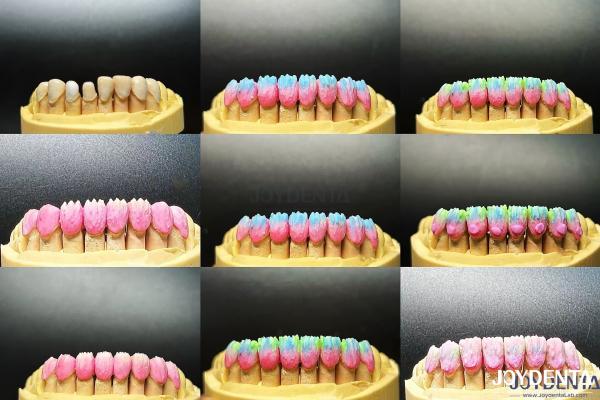 High Biocompatibility Feldspathic Ceramic Veneer Glossy For Dental Restorations