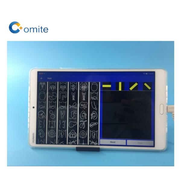 GYN ultrasound probe convex wifi usb wireless ultrasound probes for android