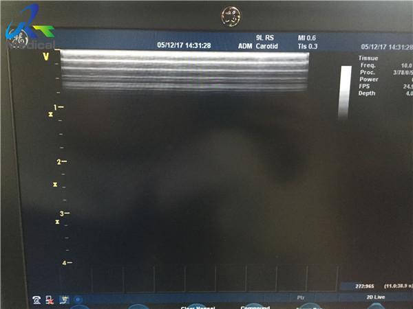 Secondhand Abdominal Ultrasound Probe For Vascular Access
