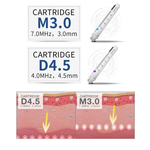 HIRONIC Ultra Private Rejuvenation HIFU Skin Tightening Machine With 2 Cartridges