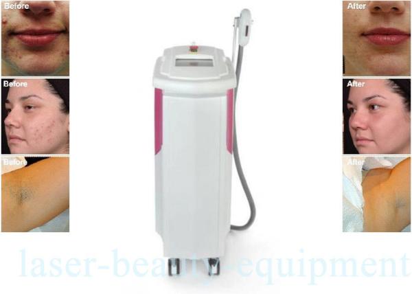 Shr IPL Intense Pulsed Light Laser Hair Removal Equipment 2500W Power For Under Arm