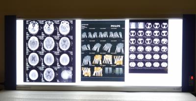 Base seca médica brilhante do azul do laser do filme da impressora térmica de X Ray