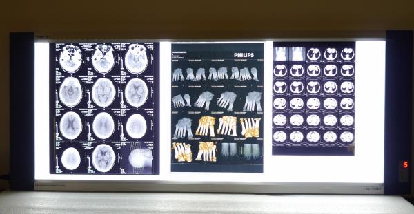 Thermal seco médico do filme de X Ray de Digitas para o CR do hospital/Dr.