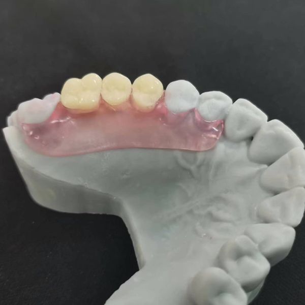 Invisible Valplast Flexible Denture Removable For Oral Restorations