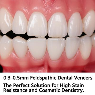 0.3-0.5mm Feldspathic Dental Veneers with 16 Shades and Long-lasting Durability for Cosmetic Dentistry