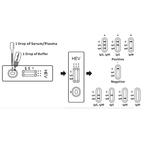 Золото анализов крови инфекционного заболевания вируса гепатита е коллоидное легко работает