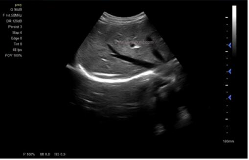 Покрасьте оборудование ультразвука машины ультразвука Допплер медицинское с 5 языками видов