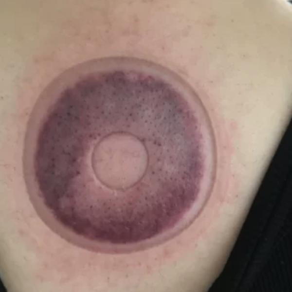 Anti-Cellulite Therapy Device Electric Vacuum Cupping Therapy for Body Guasha Scraping