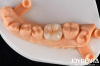 Translucent Zirconia Disc Block For Inlay Onlay Crown Restorations And Bridge Frame
