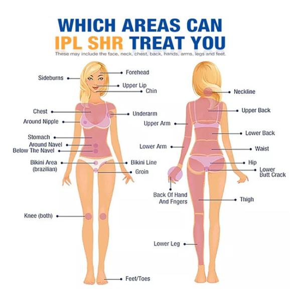 машина удаления волос лазера стороны лазера SHR 530nm 590nm Elight Ipl Rf