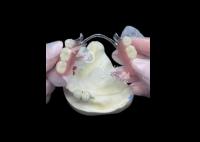 Durable Porcelain Fused To Metal Dental Crown PFM Crown For Restoration