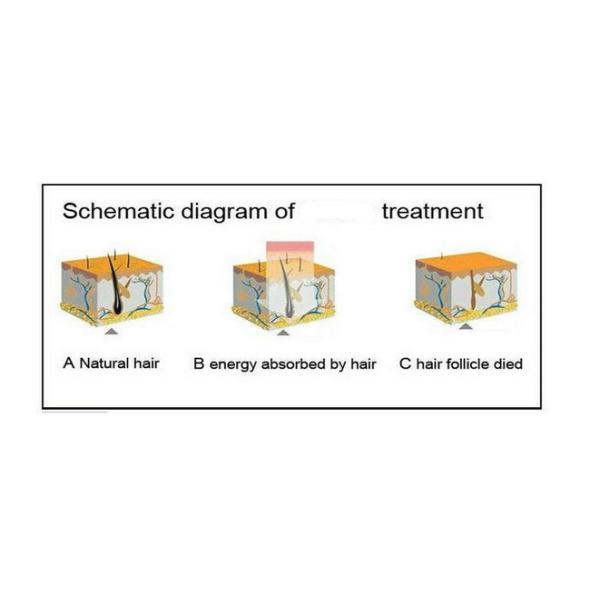 2 In 1 Painless Shr Laser Hair Removal Machine , Laser Hair Removal Device 2 Filters