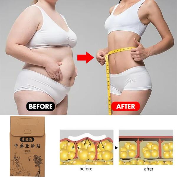 Detox Belly Slim Patch For Women Free Shipping Promotes Metabolism Fat Burning Shaping Waist Abdomen Buttock White OEM ODM