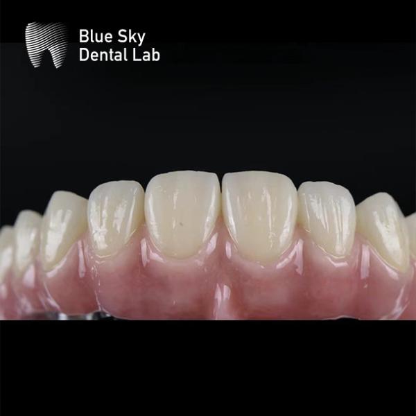 Personaliza el color de las cajas de instrumentos de implantación de superficie lisa