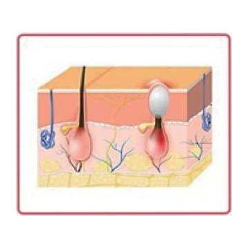 Ratio Red 660nm Infrared 850nm 1 1 Red Nir Light Therapy 300W with 60 Lamp Beads