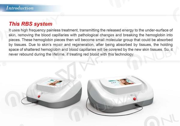 high frequency spider vein therapy removal machine for facial spider veins removal
