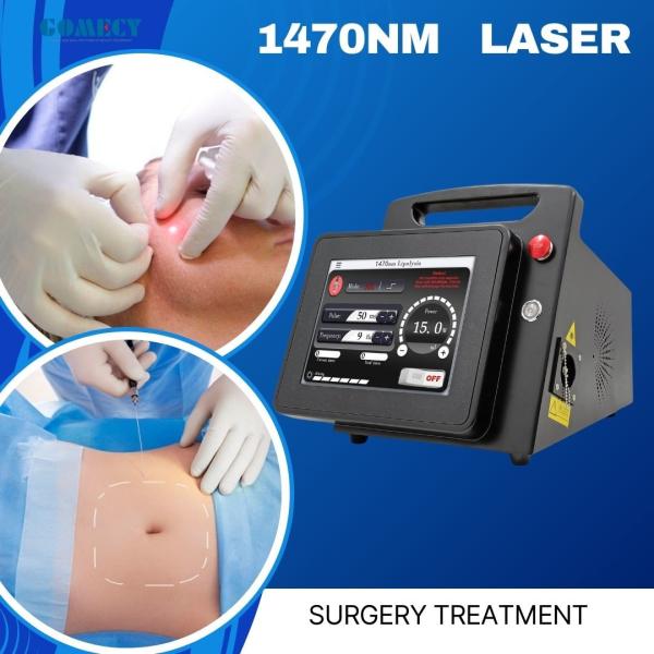 15W/20W 1470nm Endolaser for Liftinging Facial Lipolysis and Endovenous Laser Spider Vein Removal 3 Meters Fiber