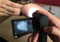 Microscopio video Dermatoscope portátil de la piel con la exhibición rotativa del color TFT de 3 pulgadas