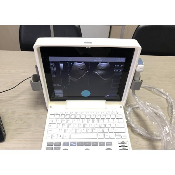 Escáner portátil del ultrasonido de 12 de la pulgada LED Digitaces de la pantalla con toda clase de puntas de prueba