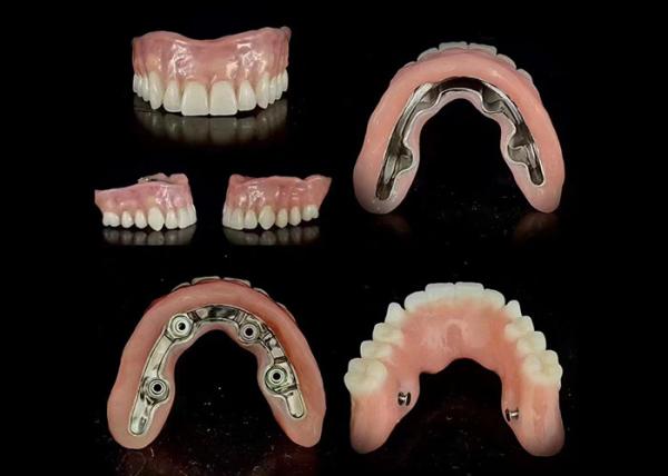 Dentures artificielles amovibles et confortables sur mesure