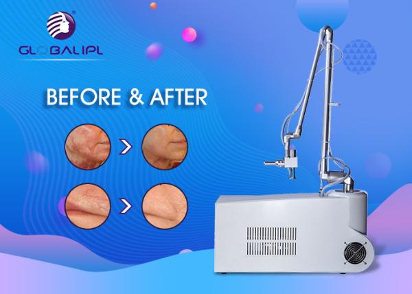 Super Pulsed CO2 Fractional Laser Machine For Face Wrinkle Removal Multifunctional