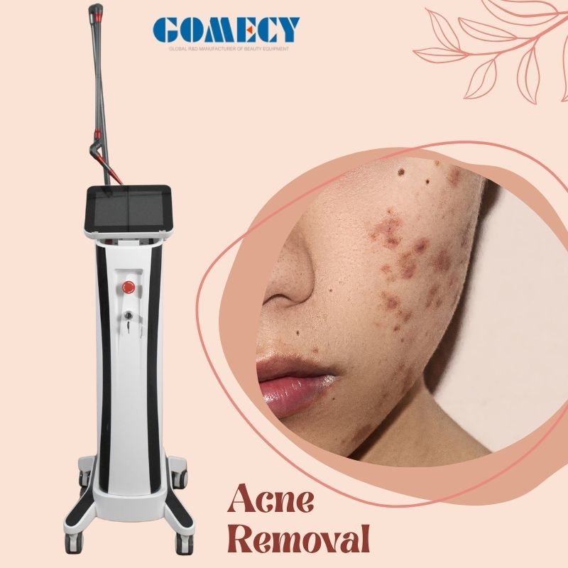 10600nm CO2 Fractional Laser Machine for Skin Rejuvenation & Face Treatment Wrinkles Removal Standing US/EU Plug