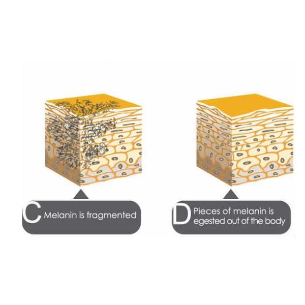 Y11 1064nm / 532nm Tattoo Removal machine For Eyebrow / Embroider Lip