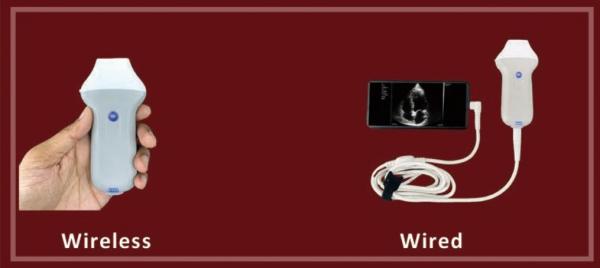 Wifi Cardiac Transducer Portable Echocardiography Probe Medical Ultrasound Scanner Price