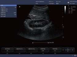 15'' LCD Display Portable Vet Ultrasound Machine Veterinary Use