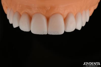 Smooth Replicated Diagnostic Wax Up FDA , Full Arch Teeth Wax Up Highly Accurate