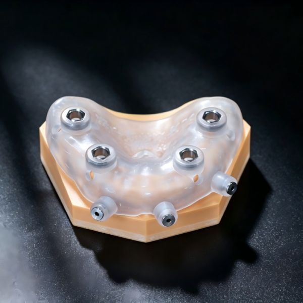 Edentulous Implant Surgical Guide Ergonomic 3D Printed Surgical Guides