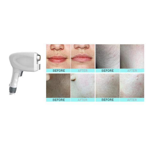 Удаление волос машины удаления волос диода салона многофункциональное