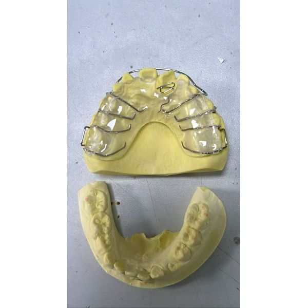 Customized Orthodontic Appliances and Dental Aligners with Digital Design and Medical-Grade Thermoplastic