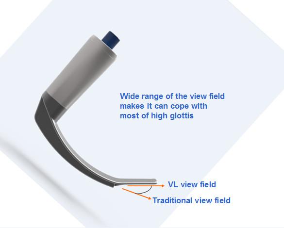 Veterinary use flexible endoscope Fiber Optic Anesthesia video laryngoscopy difficult airway pediatric neonate
