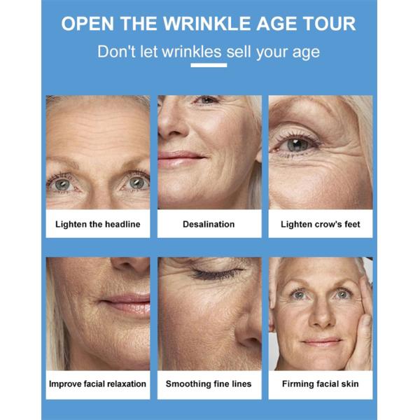 Роторный Hyaluronic кисловочный заполнитель 0.4kg губы иглы Hyaluron золота ручки свободный