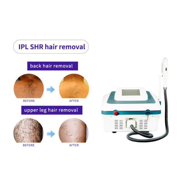 Portable Professional Ipl Hair Removal Machine , Ipl Machine For Skin Rejuvenation