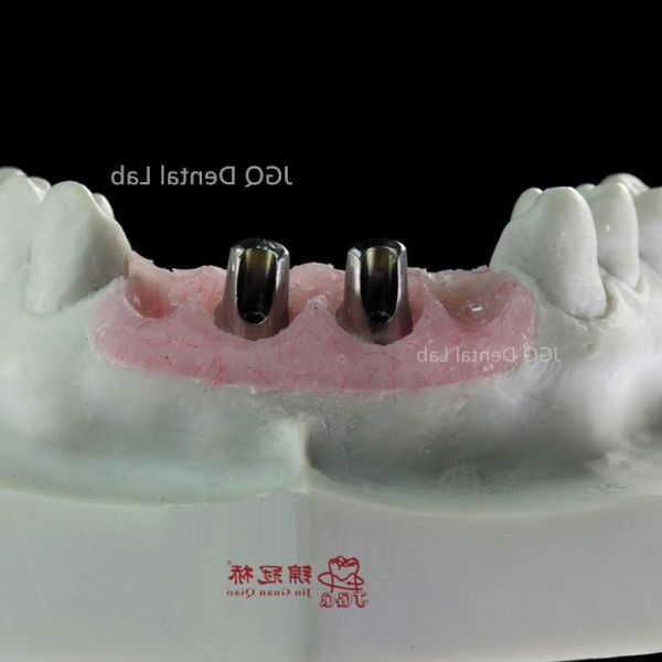 Custom Milled Dental Implant Abutments in Titanium Zirconia FDA CE Certification