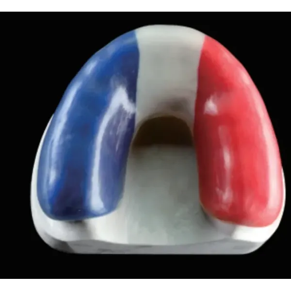 Dental Occlusal Splint Custom Made for Perfect Fit and Comfortable Night Guard Denture Lab China